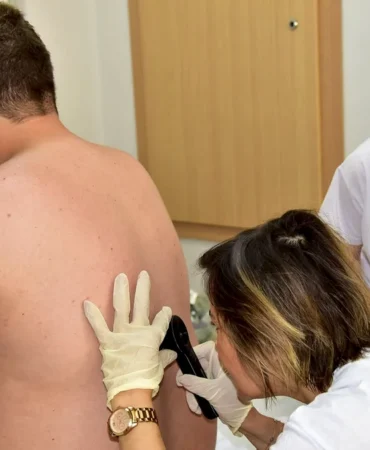 Balıkesir'de Euromelanoma 2026 Kapsamında Ücretsiz Deri Taraması